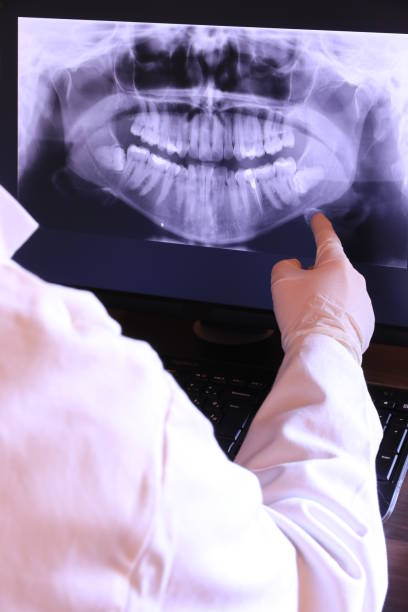 Best Emergency Treatment for Oral Infections in East Ridge, TN