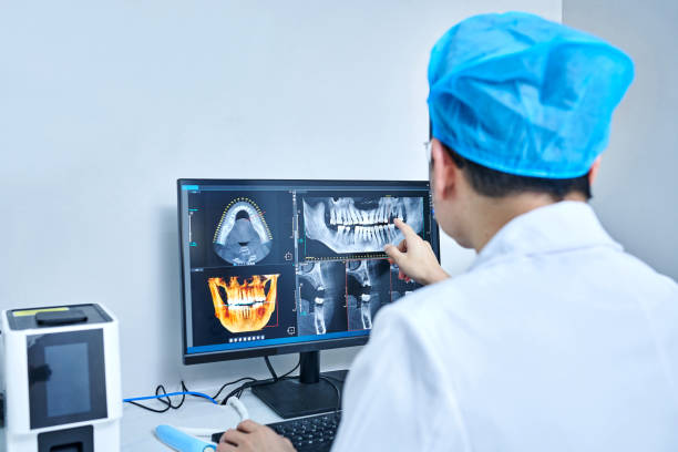Best Emergency Wisdom Tooth Extraction in East Ridge, TN