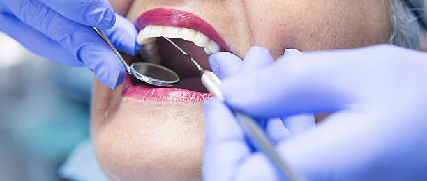 Best Emergency Root Canal Therapy in East Ridge, TN
